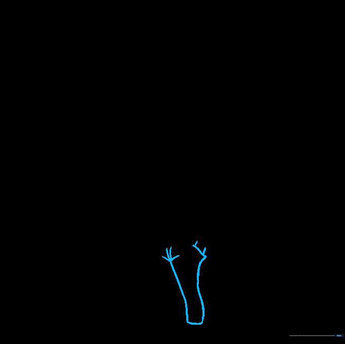 Drawing the first pant leg with a hand in the pocket.