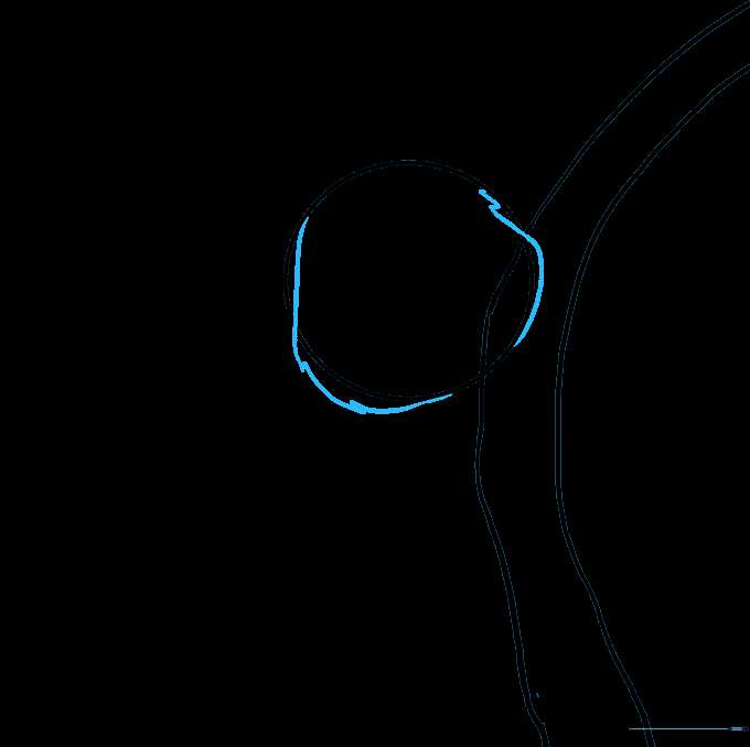 The koala head outline refined with jagged, furry-looking pencil strokes.