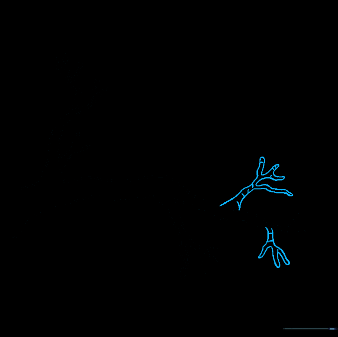 A complex tree branch structure with multiple twigs extending in different directions.
