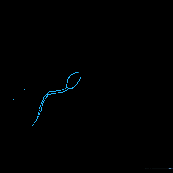The ant now has four legs, with the middle pair added to the thorax section.