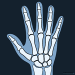 A completed, educational drawing of a human hand X-ray.