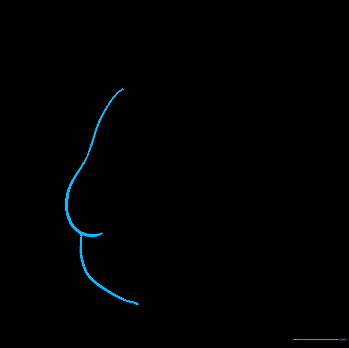 Drawing the side of the face and the sagging chin line for Bonnie.