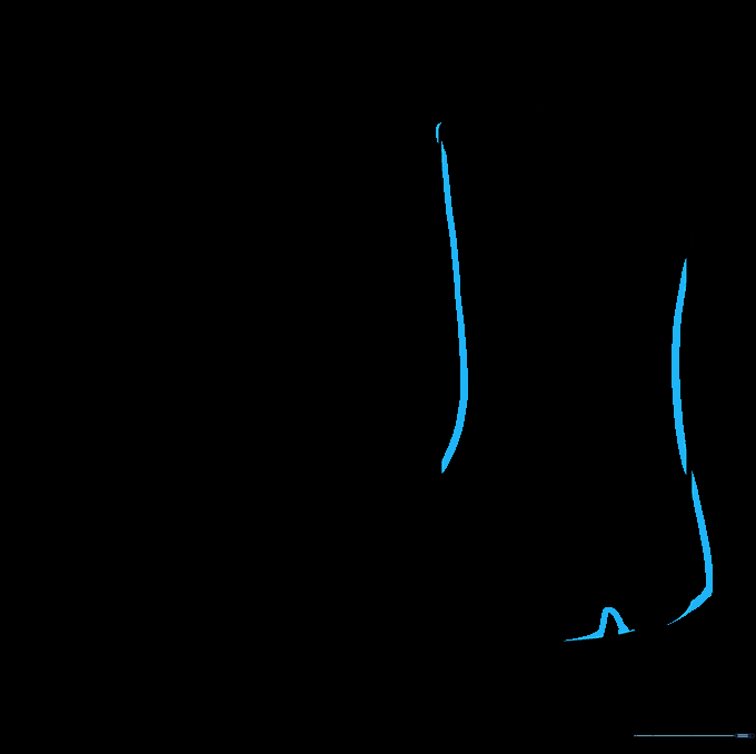 Outlining the boot shape over the cylinder guide with a defined heel triangle.
