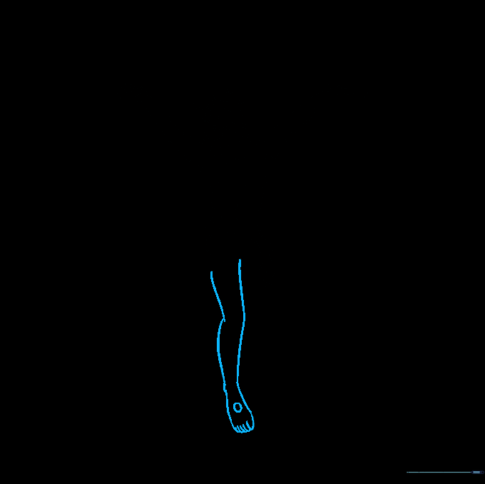 Pencil sketch of one leg with a knee bend and a small circle indicating a nail on the foot.
