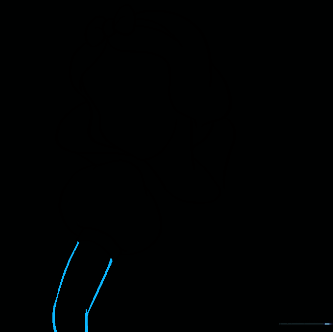 Drawing the arm extending from the puffy sleeve.