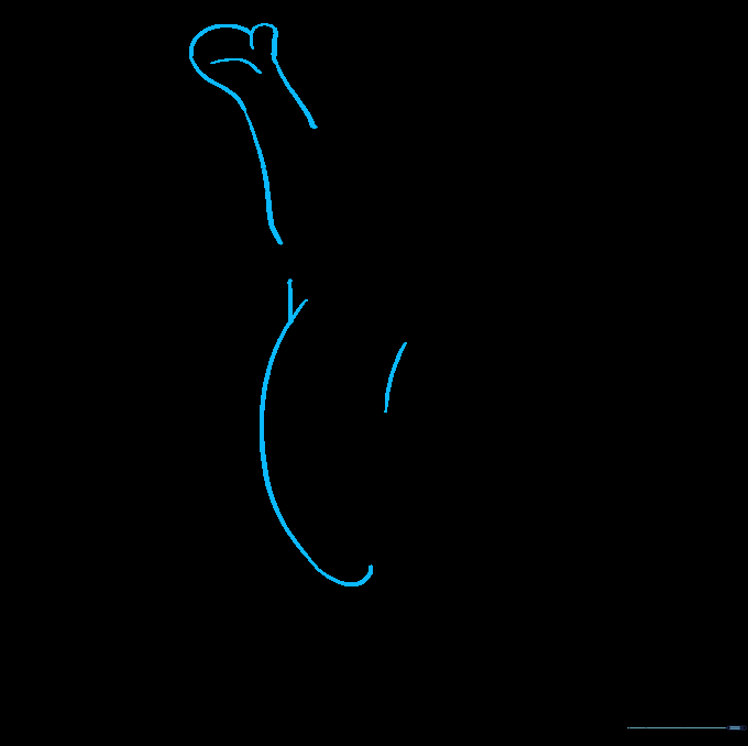 Sketch showing the second arm and the curved line defining Tigger's belly.